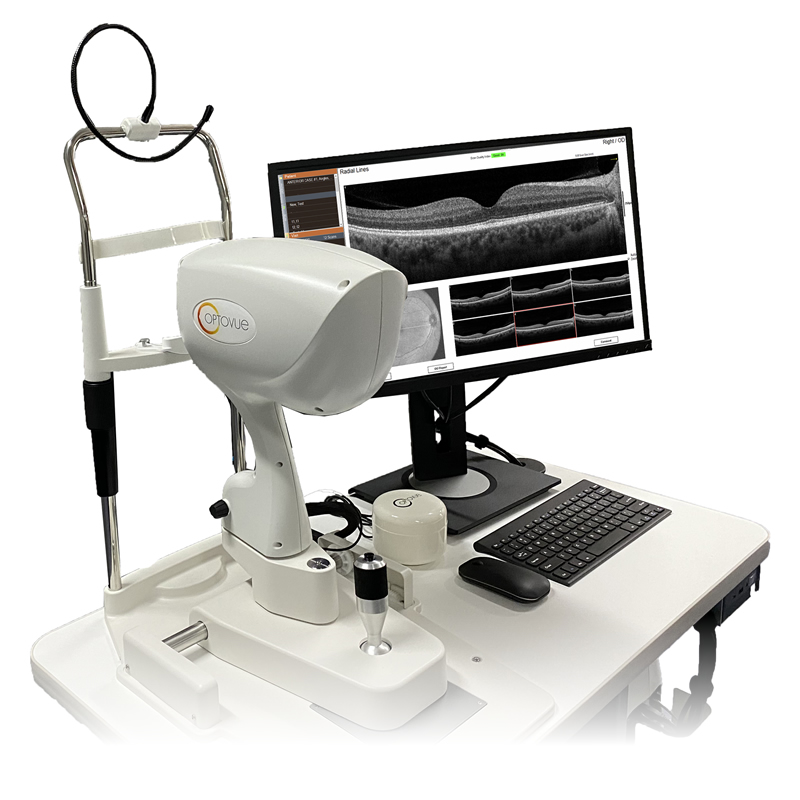 Optovue iVue 80 OCT – Optik Koherans Tomografi
